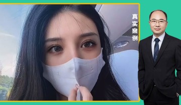 马金荣医生-黄金媚眼重睑术效果