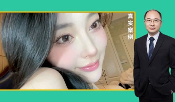 黄金媚眼重睑术效果【2】